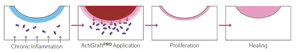 HOW-ACTIGRAFTPRO-WORKS
